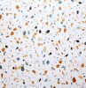 Allure Ultima Honeydew Terrazzo Look 22mil Rigid Core Luxury Vinyl Tile Flooring, 12" x 24", 23.5 sq ft New In Box $199